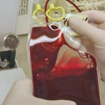 Odberový vak s pupočníkovou krvou